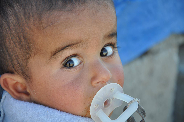 A wide-eyed child. Displaced by violence, but receiving help through IHAO and Preemptive Love Coalition.