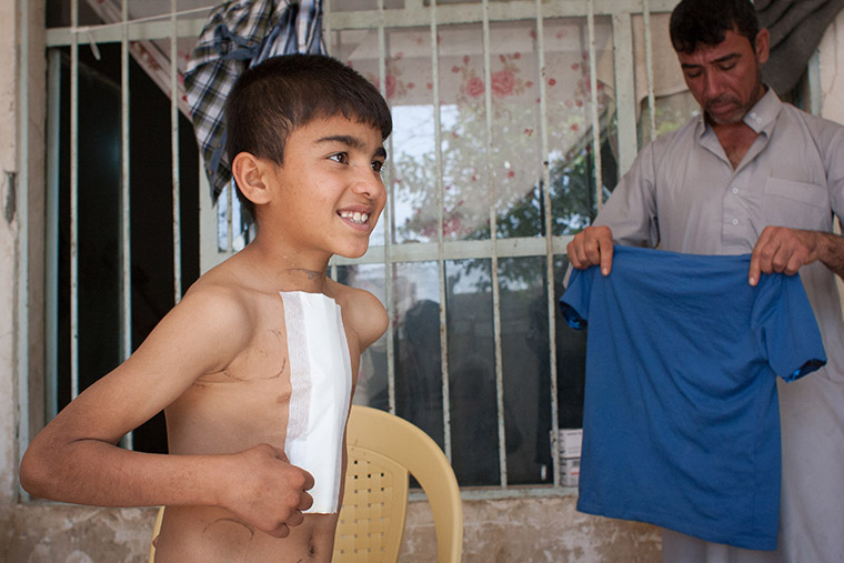Mohammad, with a fresh bandage on his chest following lifesaving heart surgery, is ready to put on his shirt. via Preemptive Love Corporation