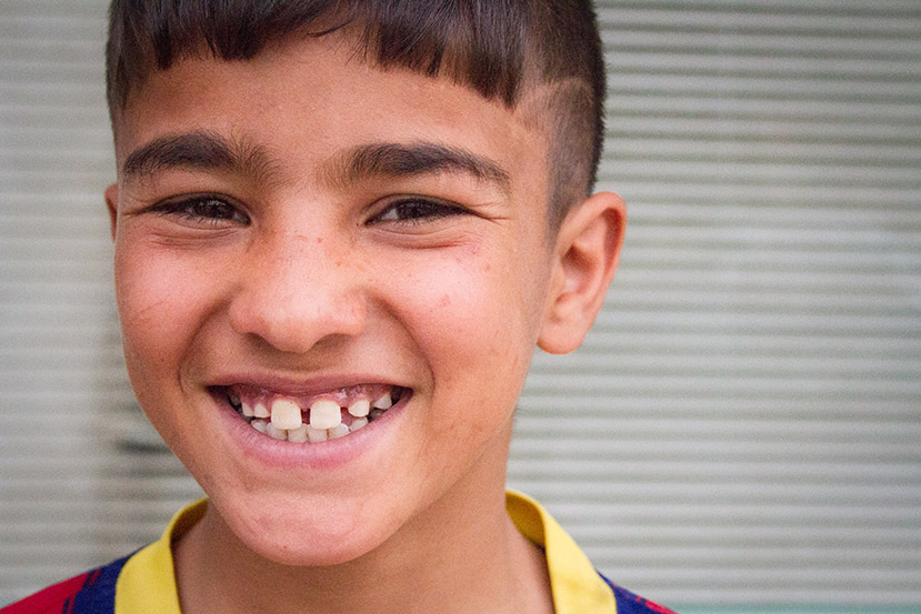 Mohammed smiles a gap-toothed grin. Waiting for heart surgery hasn't taken his smile!